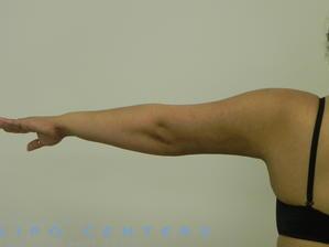 americanlipocenters_181.jpg